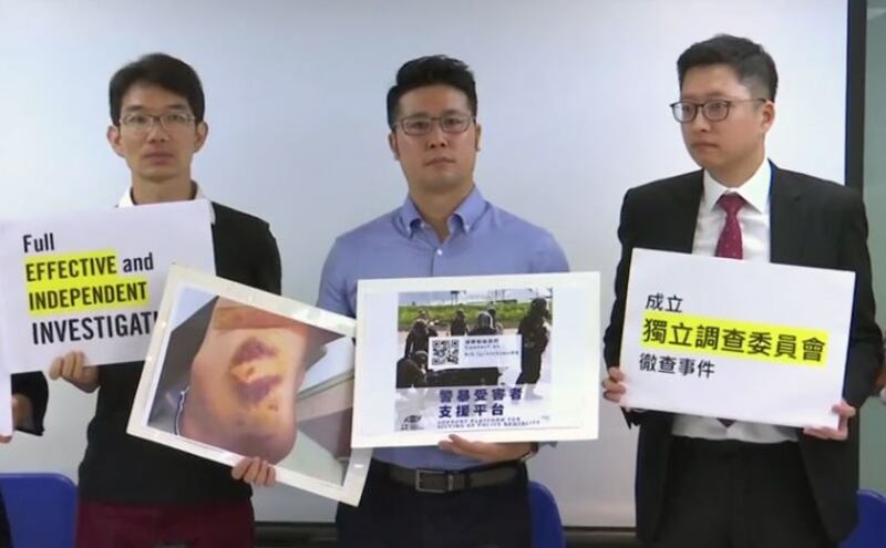 2019年6月24日,民权观察并且邀请国际特赦组织香港分会的代表召开记者会,图为香港民权观察,国际特赦组织香港分会代表,展示6-12警方清场行动中受伤的示威者伤势照片。(视频截图/路透社)