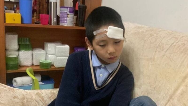 秋雨教会舒姓姐妹的八岁儿子被警察重摔在地头部受伤(志愿者提供)